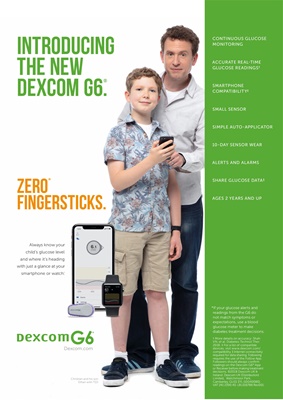 Dexcom CGM, continuous glucose monitoring