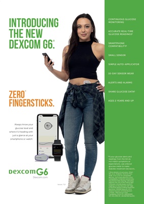 Dexcom CGM, continuous glucose monitoring